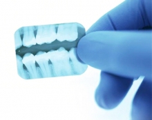 Dr. Ronen Dekalo |  Dental Surgeon
